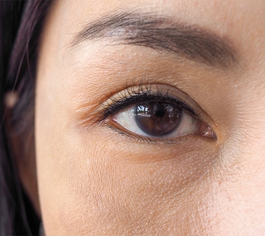 Understanding How Does Diabetes Affect the Eyes? - The Unseen Consequences of High Blood Sugar