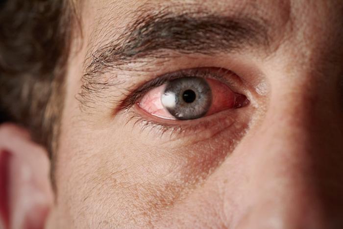 Understanding How Does Diabetes Affect the Eyes? - The Unseen Consequences of High Blood Sugar