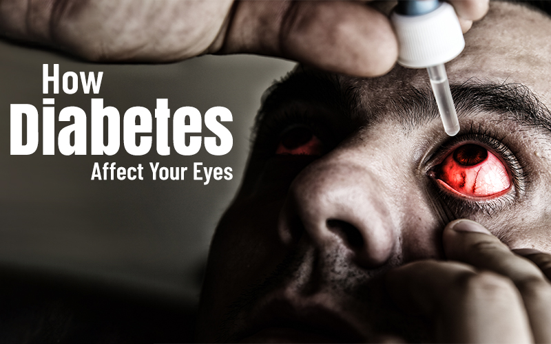 Understanding How Does Diabetes Affect the Eyes? - The Unseen Consequences of High Blood Sugar